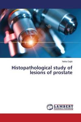 Histopathological Study of Lesions of Prostate (Paperback)