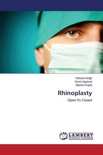 Rhinoplasty (Paperback)