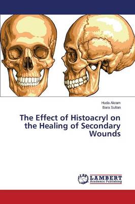 The Effect of Histoacryl on the Healing of Secondary Wounds (Paperback)