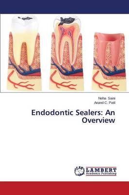 Endodontic Sealers: An Overview (Paperback)