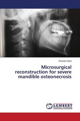 Microsurgical Reconstruction for Severe Mandible Osteonecrosis (Paperback)