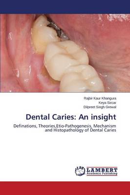 Dental Caries: An Insight (Paperback)