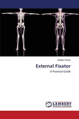 External Fixator (Paperback)
