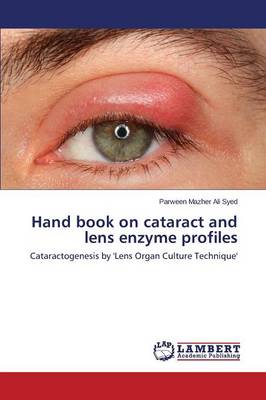 Hand Book on Cataract and Lens Enzyme Profiles (Paperback)