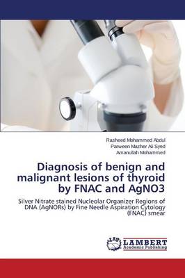 Diagnosis of Benign and Malignant Lesions of Thyroid by Fnac and Agno3 (Paperback)