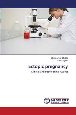Ectopic Pregnancy (Paperback)