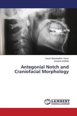 Antegonial Notch and Craniofacial Morphology (Paperback)