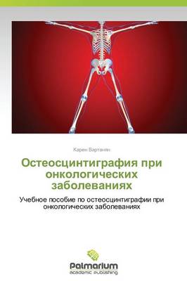 Osteostsintigrafiya Pri Onkologicheskikh Zabolevaniyakh (Paperback)