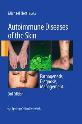 Autoimmune Diseases of the Skin: Pathogenesis, Diagnosis, Management (Paperback)