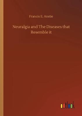 Neuralgia and The Diseases that Resemble it (Paperback)