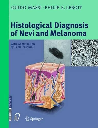 The Histological Diagnosis of Nevi and Melanoma (Hardback)