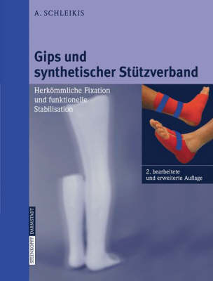 Gips Und Synthetischer Stutzverband: Herkommliche Fixation Und Funktionelle Stabilisation (Spiral bound)