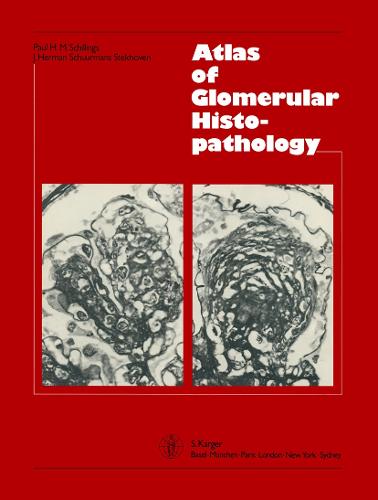 Atlas of Glomerular Histopathology (Hardback)