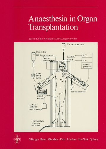 Anaesthesia in Organ Transplantation (Hardback)