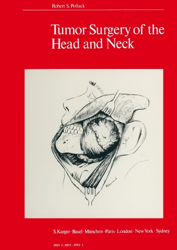 Tumor Surgery of the Head and Neck (Hardback)