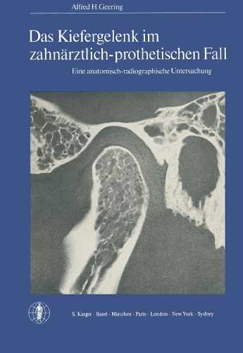 Das Kiefergelenk im zahnarztlich-prothetischen Fall: Eine anatomisch-radiographische Untersuchung. (Paperback)