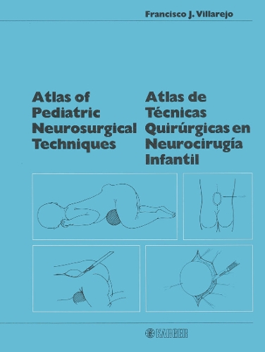 Atlas of Pediatric Neurosurgical Techniques: Atlas de Tecnicas Quirurgicas en Neurocirurgia Infantil. (Hardback)