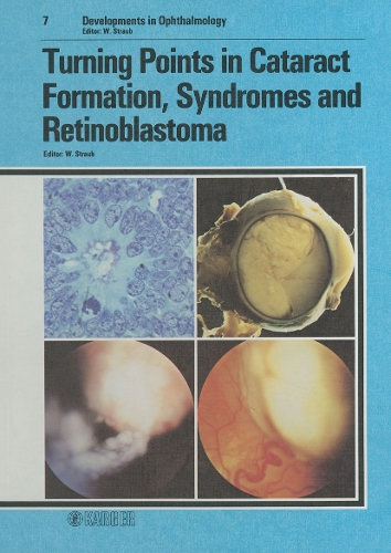 Turning Points in Cataract Formation, Syndromes and Retinoblastoma - Developments in Ophthalmology 7 (Hardback)