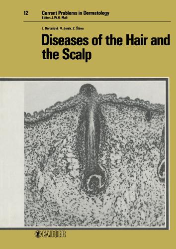Diseases of the Hair and the Scalp - Current Problems in Dermatology 12 (Hardback)