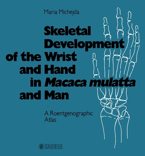Skeletal Development of the Wrist and Hand in Macaca mulatta and Man: A Roentgenographic Atlas. (Hardback)