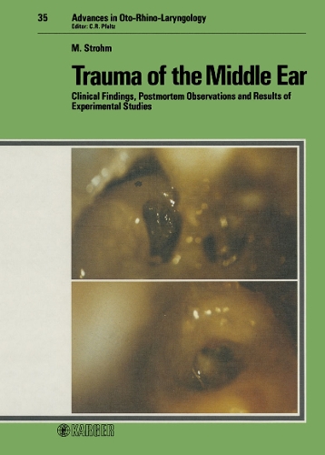 Trauma of the Middle Ear: Clinical Findings, Postmortem Observations and Results of Experimental Studies. - Advances in Oto-Rhino-Laryngology 35 (Hardback)