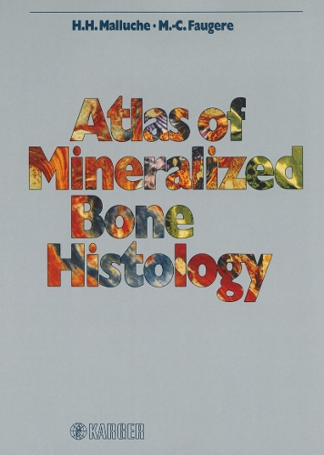 Atlas of Mineralized Bone Histology (Hardback)