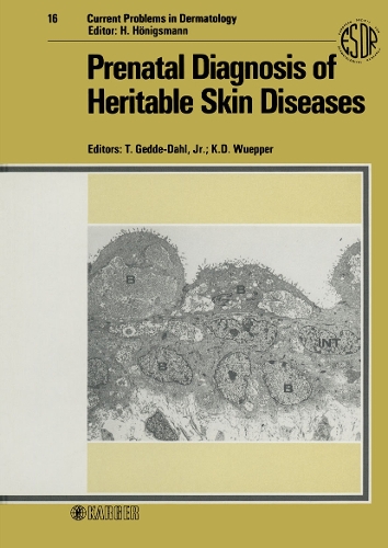 Prenatal Diagnosis of Heritable Skin Diseases: 35th Annual Symposium on the Biology of the Skin, Gleneden Beach, Oregon, October 1985, and European Society for Dermatological Research Clinically Oriented International Symposium, Oslo, February 1986. - Current Problems in Dermatology 16 (Hardback)