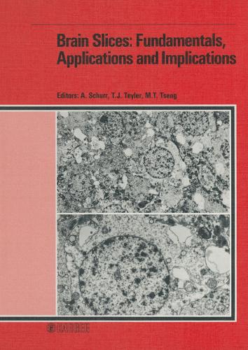 Brain Slices: Fundamentals, Applications and Implications: Conference on Brain Slices: Fundamentals, Applications and Implications, Louisville, Ky., June 1986. (Hardback)