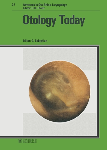 Otology Today: 2nd International Workshop, Riva del Garda, April 1986. - Advances in Oto-Rhino-Laryngology 37 (Hardback)