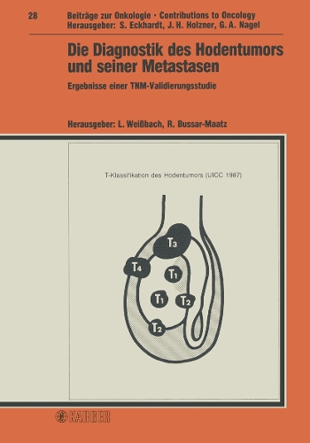 Die Diagnostik des Hodentumors und seiner Metastasen: Ergebnisse einer TNM-Validierungsstudie. - Contributions to Oncology 28 (Hardback)