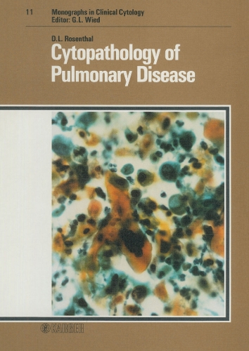 Cytopathology of Pulmonary Disease - Monographs in Clinical Cytology 11 (Hardback)