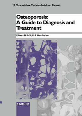 Osteoporosis: A Guide to Diagnosis and Treatment - Rheumatology 18 (Hardback)