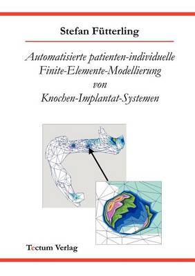 Automatisierte Patienten-Individuelle Finite-Elemente-Modellierung Von Knochen-Implantat-Systemen (Paperback)