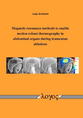 Magnetic Resonance Methods to Enable Motion Robust Thermography in Abdominal Organs During Transcutan Ablations (Paperback)