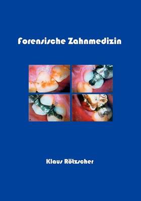 Forensische Zahnmedizin (Paperback)