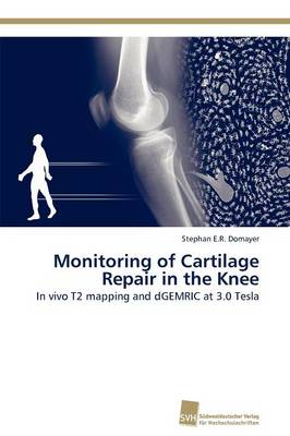 Monitoring of Cartilage Repair in the Knee (Paperback)