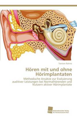 Horen Mit Und Ohne Horimplantaten (Paperback)