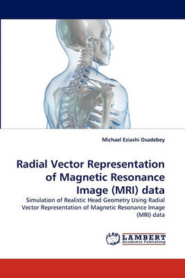 Radial Vector Representation of Magnetic Resonance Image (MRI) Data (Paperback)