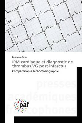 Irm Cardiaque Et Diagnostic de Thrombus Vg Post-Infarctus - Omn.Pres.Franc. (Paperback)