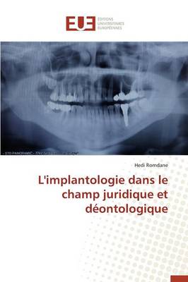 L'Implantologie Dans Le Champ Juridique Et D�ontologique - Omn.Univ.Europ. (Paperback)