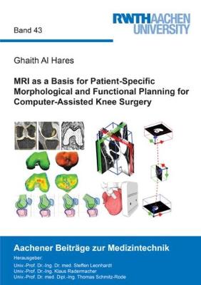 MRI as a Basis for Patient-Specific Morphological and Functional Planning for Computer-Assisted Knee Surgery - Aachener Beitrage zur Medizintechnik 43 (Paperback)