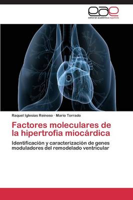 Factores Moleculares de la Hipertrofia Miocardica (Paperback)