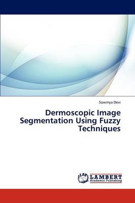 Dermoscopic Image Segmentation Using Fuzzy Techniques (Paperback)