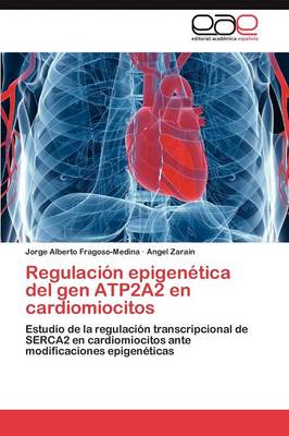 Regulacion Epigenetica del Gen Atp2a2 En Cardiomiocitos (Paperback)