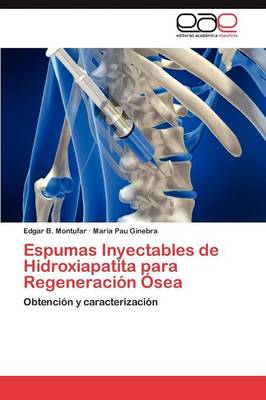 Espumas Inyectables de Hidroxiapatita Para Regeneracion Osea (Paperback)