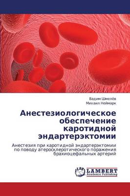 Anesteziologicheskoe Obespechenie Karotidnoy Endarterektomii (Paperback)