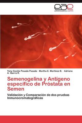Semenogelina y Antigeno Especifico de Prostata En Semen (Paperback)