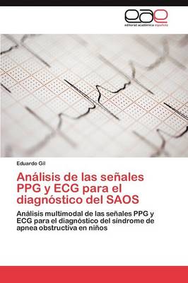 Analisis de Las Senales Ppg y ECG Para El Diagnostico del Saos (Paperback)