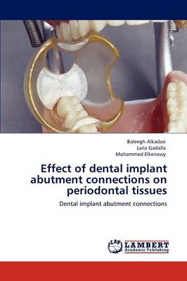 Effect of Dental Implant Abutment Connections on Periodontal Tissues (Paperback)