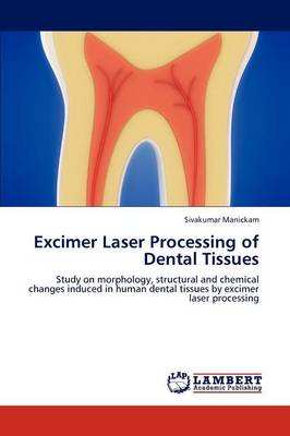 Excimer Laser Processing of Dental Tissues (Paperback)